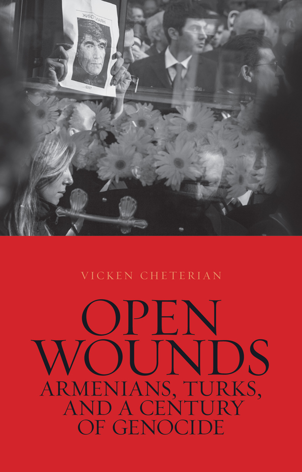 Open wounds