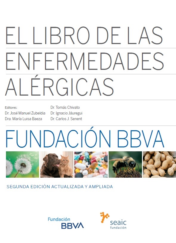 El libro de las enfermedades alérgicas. 9788492937837
