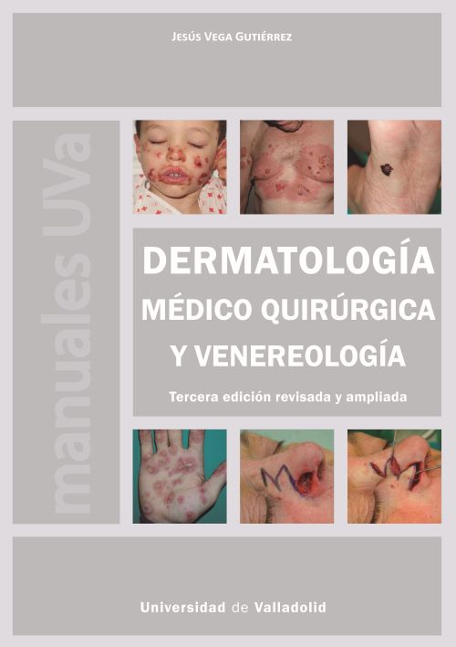Dermatología médico quirúrgica y venereología. 9788413203508